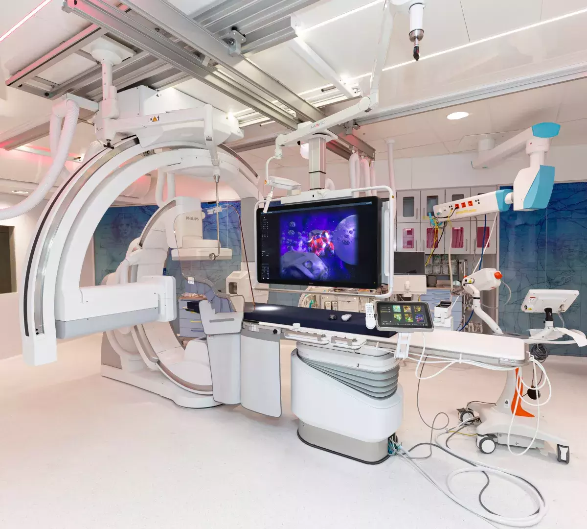 ouverture nouvelle salle maladies neuro vasculaires