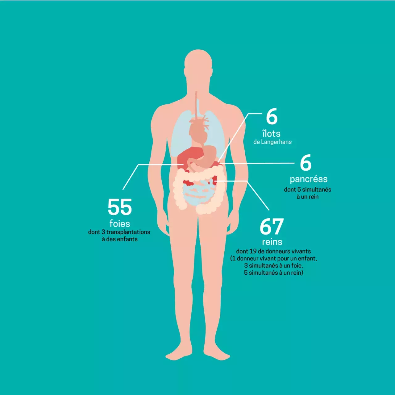 Transplantation 2021