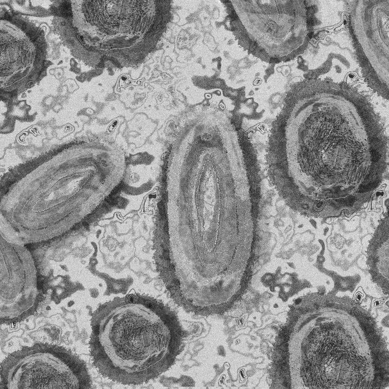 séquençage génomique du mpox