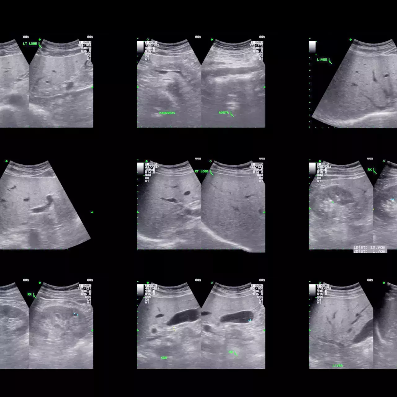 formation à l'ultrasonographie