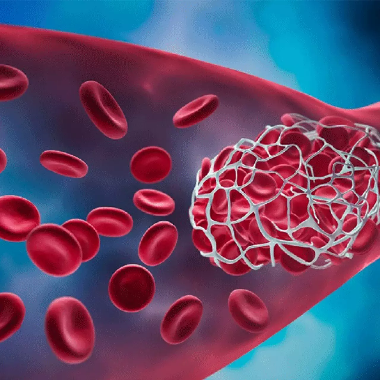 Nouveau test pour détecter les anticorps responsables d'AVC et de fausses couches