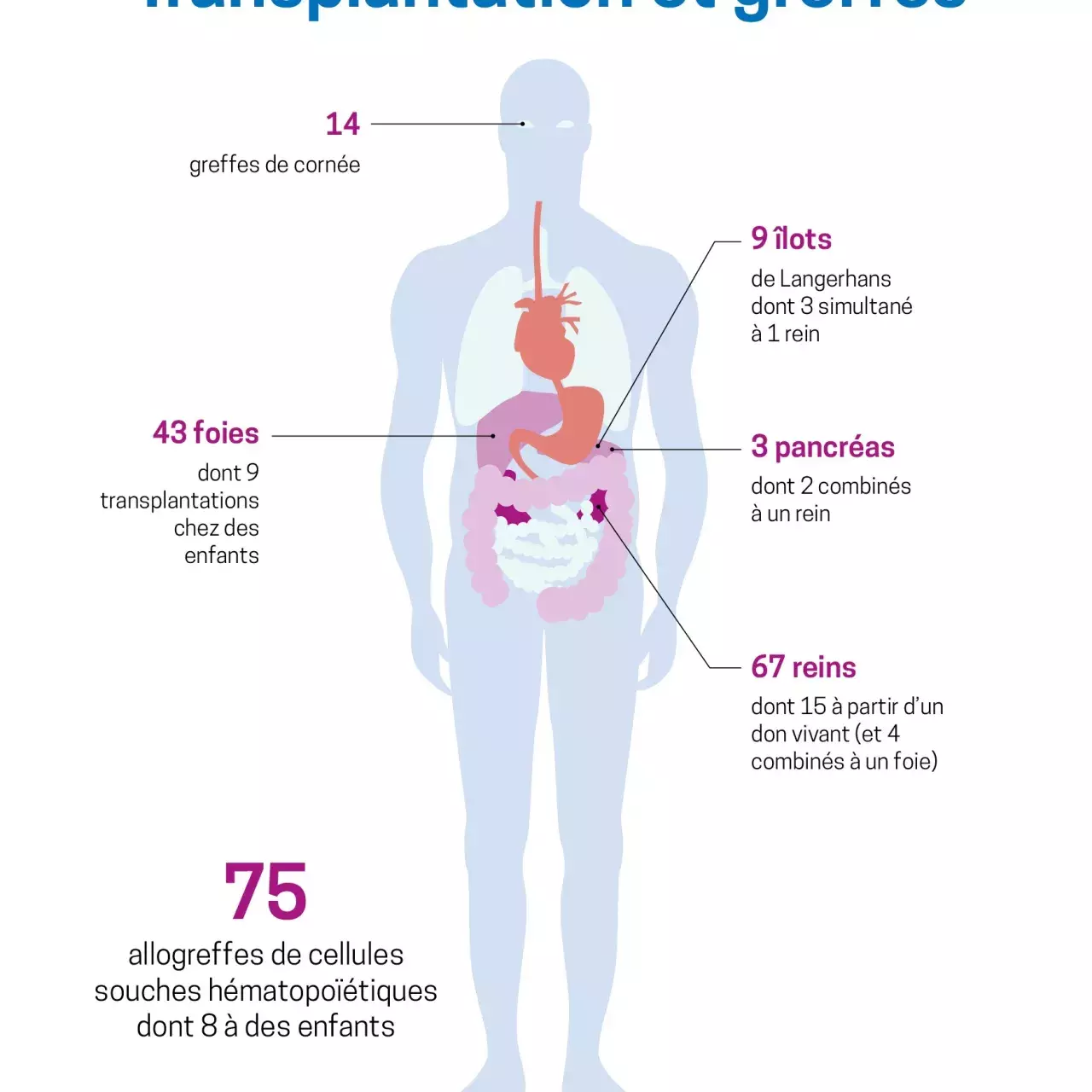 Transplantation et greffes